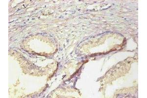 Immunohistochemical of paraffin-embedded human prostate tissue using ABIN7161512 at dilution of 1:200 (Lipocalin 2 Antikörper)