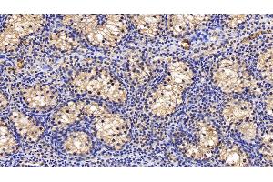 Immunohistochemistry (IHC) image for anti-Procollagen C-Endopeptidase Enhancer 2 (PCOLCE2) (AA 297-415) antibody (ABIN7438220)