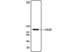 Image no. 1 for anti-Poly (ADP-Ribose) Polymerase 1 (PARP1) (N-Term) antibody (ABIN307559) (PARP1 Antikörper  (N-Term))
