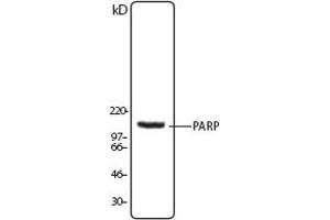 Image no. 1 for anti-Poly (ADP-Ribose) Polymerase 1 (PARP1) (N-Term) antibody (ABIN307559) (PARP1 Antikörper  (N-Term))