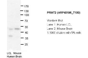 Image no. 1 for anti-Protein Arginine Methyltransferase 2 (PRMT2) (N-Term) antibody (ABIN183891)