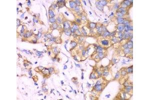Immunohistochemistry (Paraffin-embedded Sections) (IHC (p)) image for anti-Ribosomal Protein S3A (RPS3A) antibody (ABIN7261840)