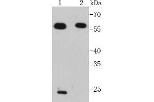 Lane 1: Jurkat, Lane 2: Raji lysates probed with IRF7 (2A1) Monoclonal Antibody  at 1:1000 overnight at 4˚C. (IRF7 Antikörper)