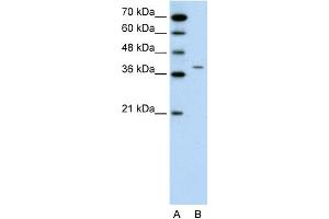 WB Suggested Anti-RAPSN Antibody Titration:  0. (RAPSN Antikörper  (N-Term))