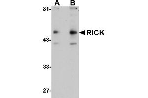 Western Blotting (WB) image for anti-Receptor-Interacting Serine-threonine Kinase 2 (RIPK2) (C-Term) antibody (ABIN1030619) (RIPK2 Antikörper  (C-Term))
