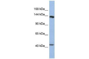 SLIT1 antibody used at 1 ug/ml to detect target protein. (SLIT1 Antikörper)