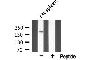 Western blot analysis of extracts from rat spleen, using MLH3 antibody. (MLH3 Antikörper  (Internal Region))