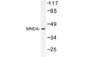Image no. 1 for anti-Myeloid Cell Nuclear Differentiation Antigen (MNDA) antibody (ABIN317919) (MNDA Antikörper)