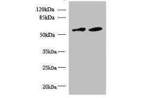 Western blot All lanes: KBTBD4 antibody at 10 μg/mL Lane 1: U87 whole cell lysate Lane 2: NIH/3T3 whole cell lysate Secondary Goat polyclonal to rabbit IgG at 1/10000 dilution Predicted band size: 59, 60 kDa Observed band size: 59 kDa (KBTBD4 Antikörper  (AA 151-415))
