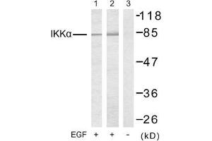 Image no. 2 for anti-conserved Helix-Loop-Helix Ubiquitous Kinase (CHUK) (Thr23) antibody (ABIN197306) (IKK alpha Antikörper  (Thr23))