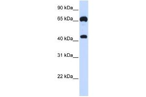 WB Suggested Anti-GUCY1B3 Antibody Titration:  0. (GUCY1B3 Antikörper  (N-Term))