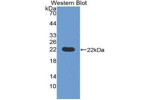 Western blot analysis of the recombinant protein. (Pronociceptin (AA 20-176) Antikörper)