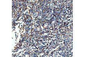 IHC analysis of VCAM1 using anti-VCAM1 antibody (ABIN5692810).