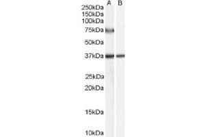 Image no. 1 for anti-Acyl-CoA Oxidase 2, Branched Chain (Acox2) (C-Term), (Internal Region) antibody (ABIN374845) (Acox2 Antikörper  (C-Term, Internal Region))