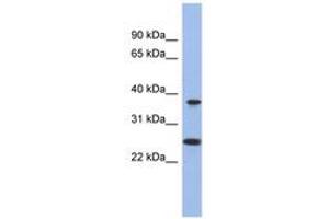 Image no. 1 for anti-Mitochondrial Translational Release Factor 1-Like (MTRF1L) (N-Term) antibody (ABIN6743271) (MTRF1L Antikörper  (N-Term))