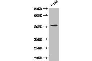 Western Blot Positive WB detected in: Mouse lung tissue All lanes: CORO1A antibody at 2. (Coronin 1a Antikörper  (AA 363-432))