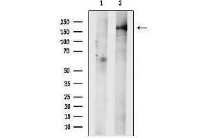 anti-Growth Regulation By Estrogen in Breast Cancer 1 (GREB1) (Internal Region) antibody