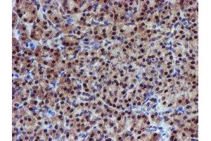 Image no. 7 for anti-Proteasome (Prosome, Macropain) 26S Subunit, Non-ATPase, 2 (PSMD2) antibody (ABIN1500479)