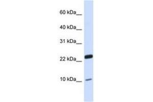 Image no. 1 for anti-TAF13 RNA Polymerase II, TATA Box Binding Protein (TBP)-Associated Factor, 18kDa (TAF13) (N-Term) antibody (ABIN6743455) (TAF13 Antikörper  (N-Term))