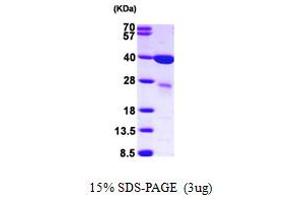 SDS-PAGE (SDS) image for Lectin, Galactoside-Binding, Soluble, 8 (LGALS8) (AA 1-317) protein (His tag) (ABIN667193)