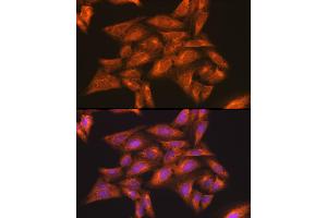 Immunofluorescence analysis of U-2 OS cells using IKKγ Rabbit pAb (ABIN3021150, ABIN3021151, ABIN3021152 and ABIN6214025) at dilution of 1:100 (40x lens).