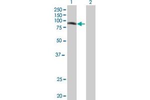 Western Blot analysis of PHF16 expression in transfected 293T cell line by PHF16 MaxPab polyclonal antibody. (PHF16 Antikörper  (AA 1-823))