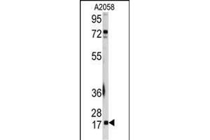Western blot analysis of anti-UBE2I Antibody (N-term) (ABIN387910 and ABIN2844306) in  cell line lysates (35 μg/lane).