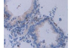 Immunohistochemistry (IHC) image for anti-Signal Transducer and Activator of Transcription 2, 113kDa (STAT2) (AA 587-838) antibody (ABIN7443368)