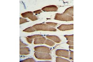 Formalin-fixed and paraffin-embedded human skeletal muscle with WNT5B Antibody (Center), which was peroxidase-conjugated to the secondary antibody, followed by DAB staining. (WNT5B Antikörper  (AA 153-182))