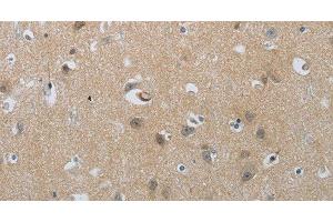 Immunohistochemistry (Paraffin-embedded Sections) (IHC (p)) image for anti-Natriuretic Peptide Receptor A/guanylate Cyclase A (Atrionatriuretic Peptide Receptor A) (NPR1) antibody (ABIN7241978)