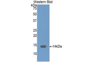 Detection of Recombinant SAA, Human using Polyclonal Antibody to Serum Amyloid A (SAA) (SAA Antikörper  (AA 19-122))