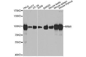 Western Blotting (WB) image for anti-Ribonucleotide Reductase M1 (RRM1) (AA 593-792) antibody (ABIN3021563)