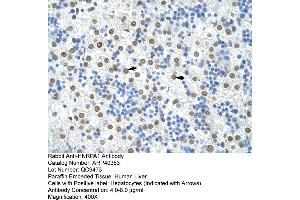 Rabbit Anti-HNRPA1 Antibody  Paraffin Embedded Tissue: Human Liver Cellular Data: Hepatocytes Antibody Concentration: 4. (HNRNPA1 Antikörper  (N-Term))