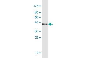 Western Blot detection against Immunogen (36. (PRKCDBP Antikörper  (AA 161-261))