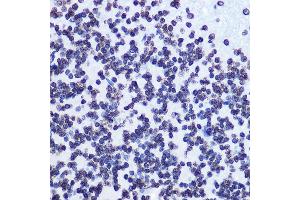 Immunohistochemistry of paraffin-embedded rat brain using Phospho-SMC1-S957 Rabbit mAb (ABIN7270613) at dilution of 1:100 (40x lens). (SMC1A Antikörper  (pSer957))