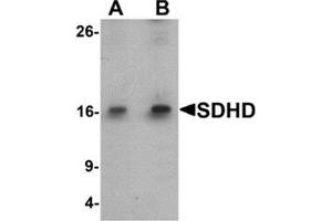 Western blot analysis of SDHD in EL4 cell lysate with SDHD antibody at (A) 1 and (B) 2 ug/mL. (SDHD Antikörper  (Middle Region))