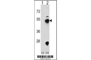 Western blot analysis of FDPS using rabbit polyclonal FDPS Antibody (D31) using 293 cell lysates (2 ug/lane) either nontransfected (Lane 1) or transiently transfected (Lane 2) with the FDPS gene. (FDPS Antikörper  (N-Term))