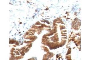 IHC testing of FFPE human gallbladder with TOP1MT antibody (clone TPIMT-1). (TOP1MT Antikörper)