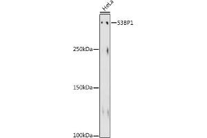Western blot analysis of extracts of HeLa cells, using 53BP1 antibody (ABIN1679832, ABIN3018199, ABIN3018200 and ABIN7101582) at 1:500 dilution. (TP53BP1 Antikörper)