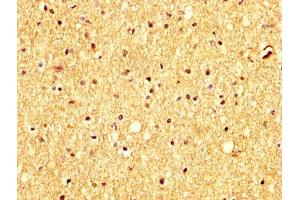 IHC image of ABIN7144013 diluted at 1:300 and staining in paraffin-embedded human brain tissue performed on a Leica BondTM system. (RHCG Antikörper  (AA 416-479))