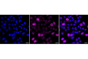 Immunocytochemical staining of HepG2 cells with Cyclin A2 antibody (ABIN7798186), 1:1,000). (Rekombinanter Cyclin A Antikörper)