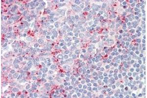 Immunohistochemistry (IHC) image for anti-Leukocyte Immunoglobulin-Like Receptor, Subfamily B (With TM and ITIM Domains), Member 2 (LILRB2) (C-Term) antibody (ABIN1909857)