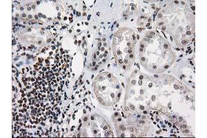 Immunohistochemical staining of paraffin-embedded Human Kidney tissue using anti-PRKCE mouse monoclonal antibody. (PKC epsilon Antikörper)