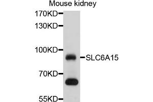 Western blot analysis of extracts of mouse kidney, using SLC6A15 antibody (ABIN4905212) at 1:1000 dilution. (SLC6A15 Antikörper)