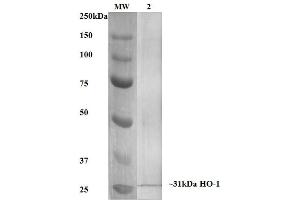 Western Blot analysis of Human, Mouse, Rat Rat Kidney Lysate showing detection of ~31 kDa HO-1 protein using Mouse Anti-HO-1 Monoclonal Antibody, Clone 6B8-2F2 .