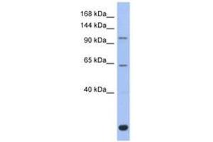 Image no. 1 for anti-BTB and CNC Homology 1, Basic Leucine Zipper Transcription Factor 2 (BACH2) (C-Term) antibody (ABIN6742357)