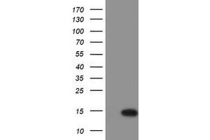 Western Blotting (WB) image for anti-Chromosome 17 Open Reading Frame 37 (C17orf37) antibody (ABIN1501778) (C17orf37 Antikörper)