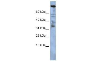 Western Blot showing ZNF251 antibody used at a concentration of 1-2 ug/ml to detect its target protein. (ZNF251 Antikörper  (Middle Region))