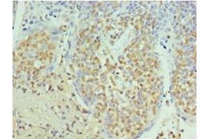 Immunohistochemistry of paraffin-embedded human tonsil tissue using ABIN7168869 at dilution of 1:100 (Septin 6 Antikörper  (AA 350-434))