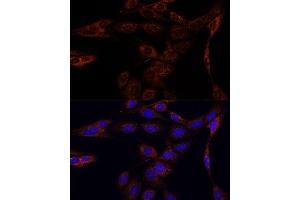 Immunofluorescence analysis of C6 cells using PFDN4 antibody (ABIN7269508) at dilution of 1:100. (PFDN4 Antikörper  (AA 1-134))